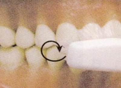 Tehnika kružnog pranja zuba